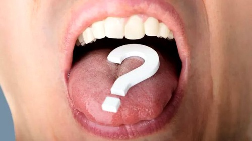 Слово на кончике языка